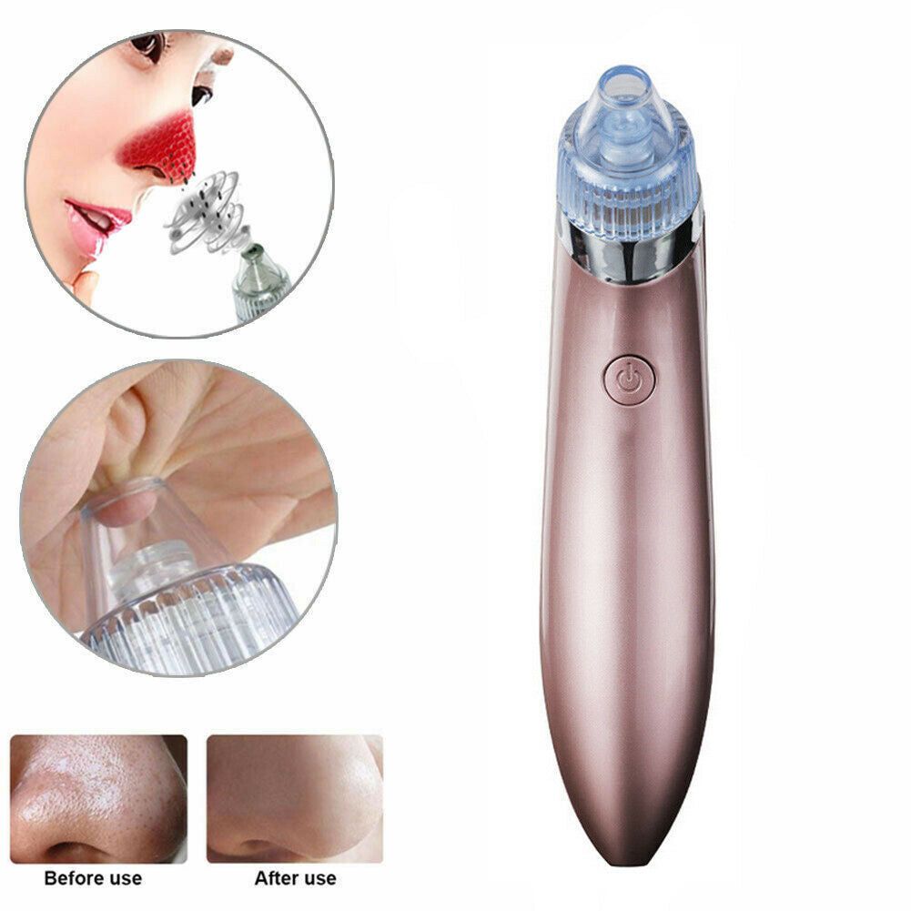 Electric Blackhead Remover – Strong Suction Pore Vacuum Cleaner