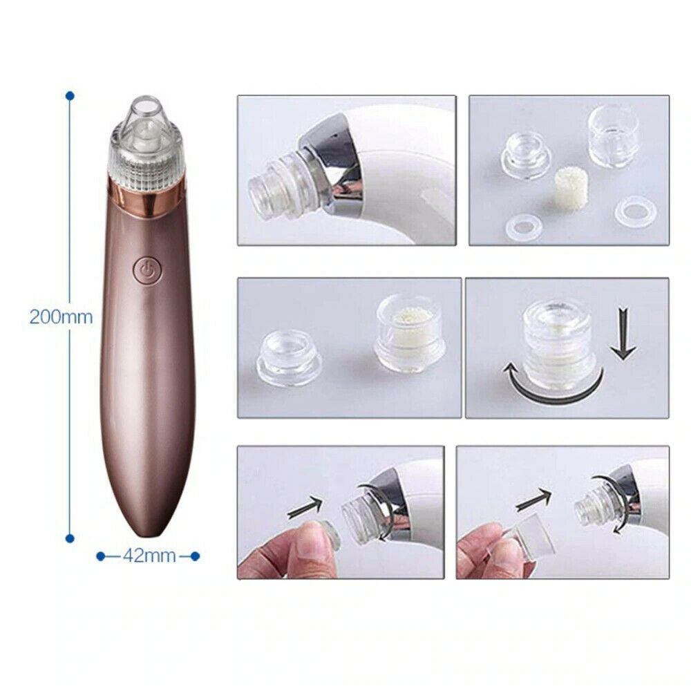 Electric Blackhead Remover – Strong Suction Pore Vacuum Cleaner