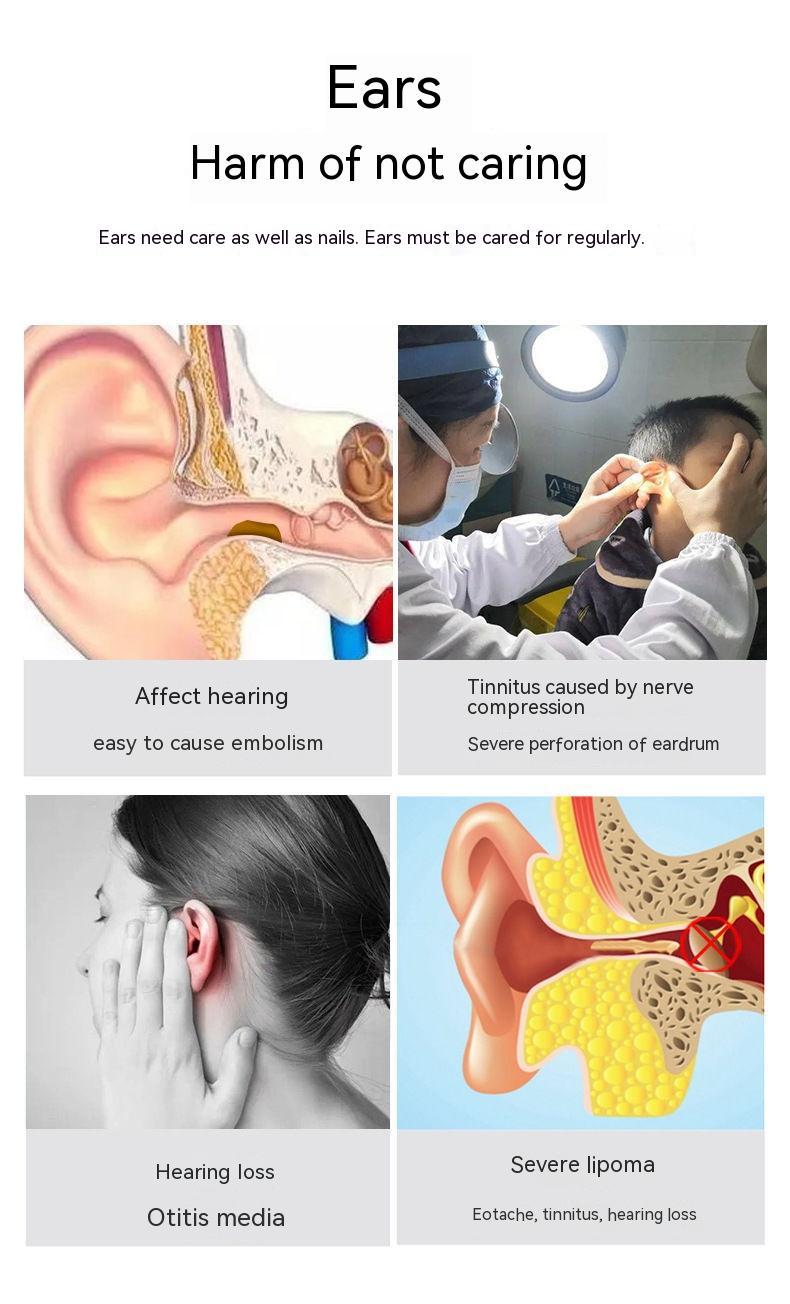 Wireless Smart HD Endoscope Ear Cleaner – Luminous Ear Pick Tool