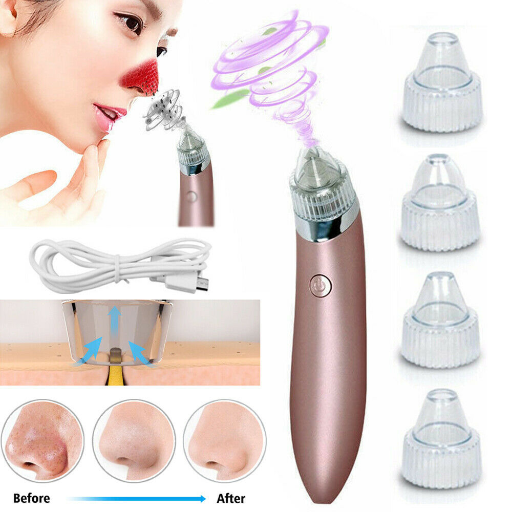 Electric Blackhead Remover – Strong Suction Pore Vacuum Cleaner