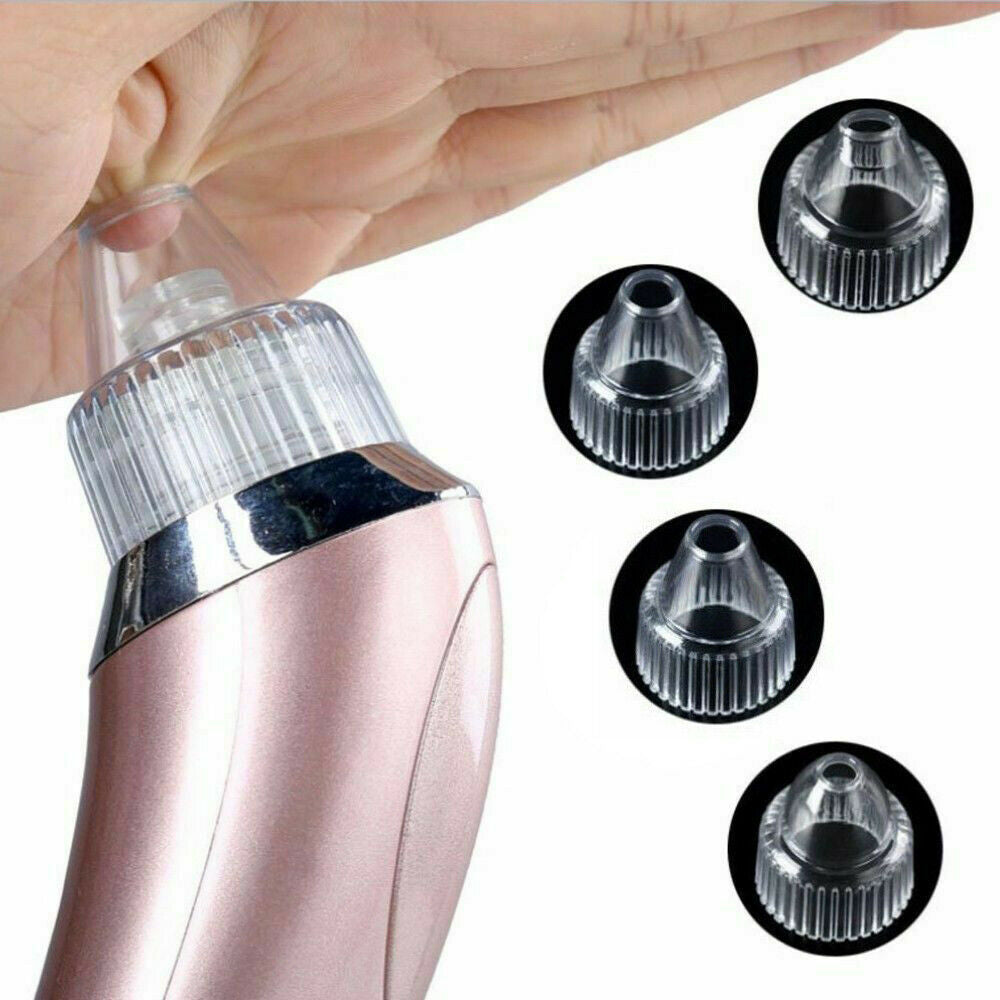 Electric Blackhead Remover – Strong Suction Pore Vacuum Cleaner