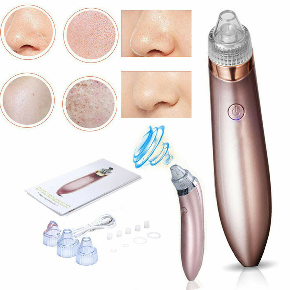 Electric Blackhead Remover – Strong Suction Pore Vacuum Cleaner